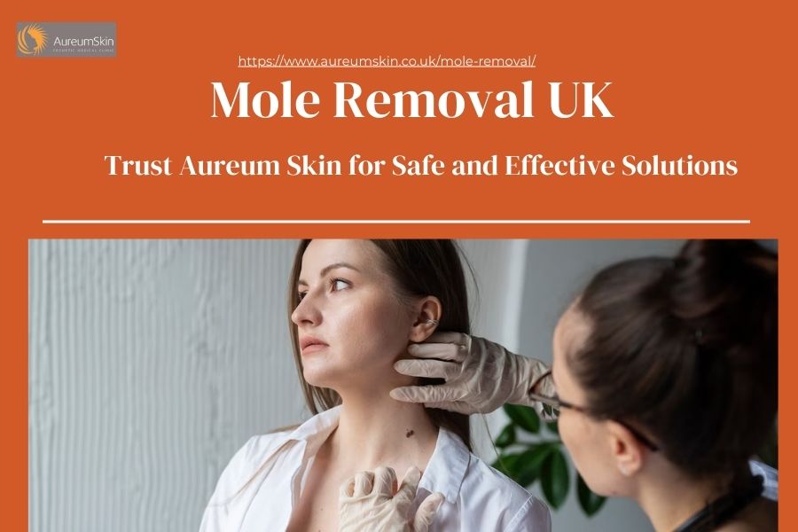 Mole Removal UK: